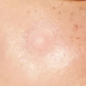 Onion Newpair Spot Patch (12mmx12ea/10mmx12ea)