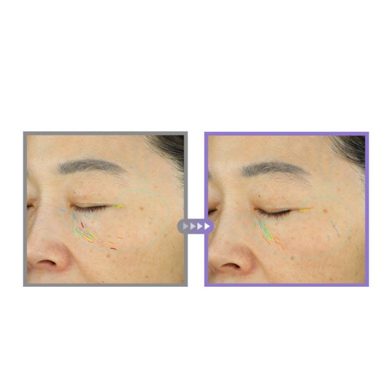 360° SHOT PDRN ACTIVE SERUM