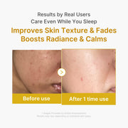 Kojic Acid Turmeric Night Wrapping Mask 75 ml